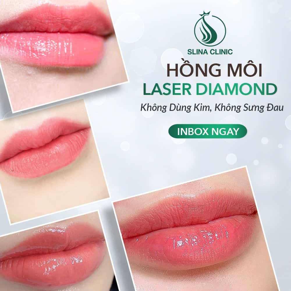 Cách trị thâm môi bằng công nghệ Laser Diamond