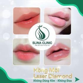 Khử thâm môi bằng phương pháp không sưng đau tại Slina