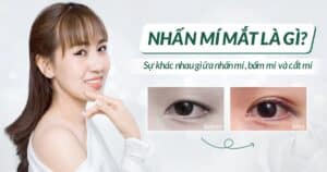 Nhấn mí mắt là gì?