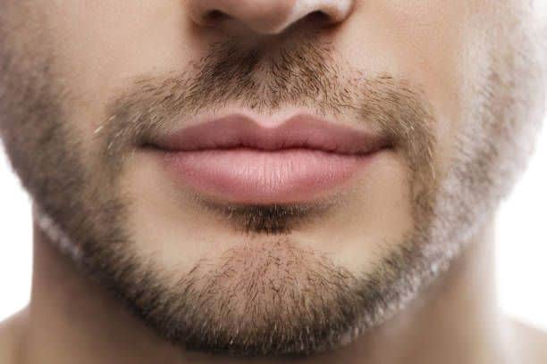 Nam giới có nên khử thâm môi không?