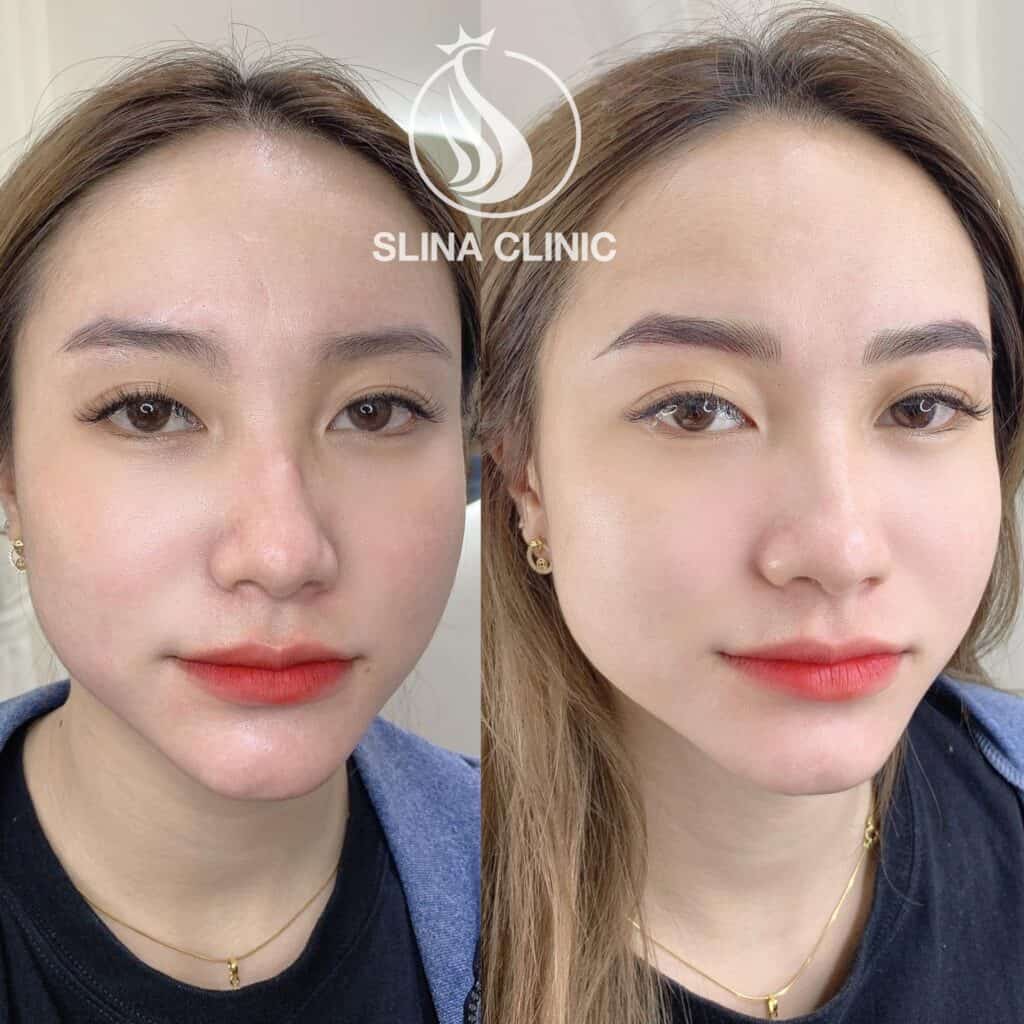 chân mày thêu 3d là gì